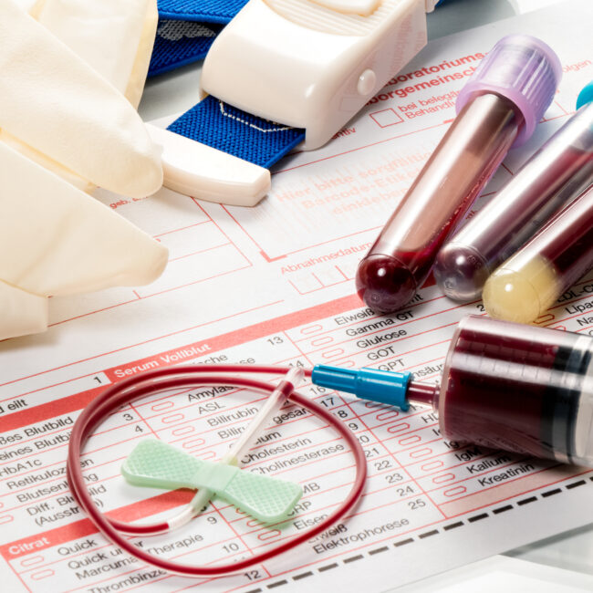 Blood samples are on a laboratory form for Finding out the blood values